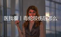 医我看丨毒蛇咬伤后怎么办？自救+血清治疗一步都不能漏
