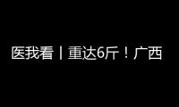 医我看丨重达6斤！广西女子乳腺肿瘤2年疯长至篮球大
，医生提醒：这些情况务必重视
