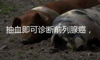 抽血即可诊断前列腺癌，拜登为何不测？