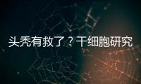 头秃有救了？干细胞研究阐明压力如何影响毛发生长