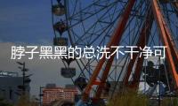脖子黑黑的总洗不干净可能是病了	，这些疾病信号赶紧自查